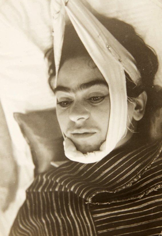 Frida Kahlo accidente