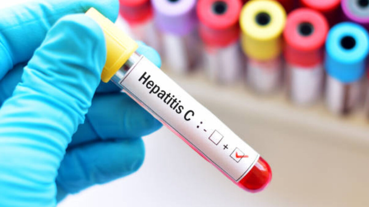 hepatitis C tips prevenir
