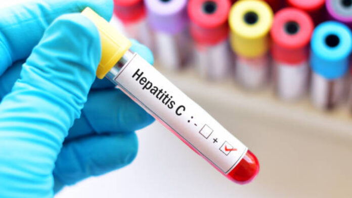 hepatitis C tips prevenir