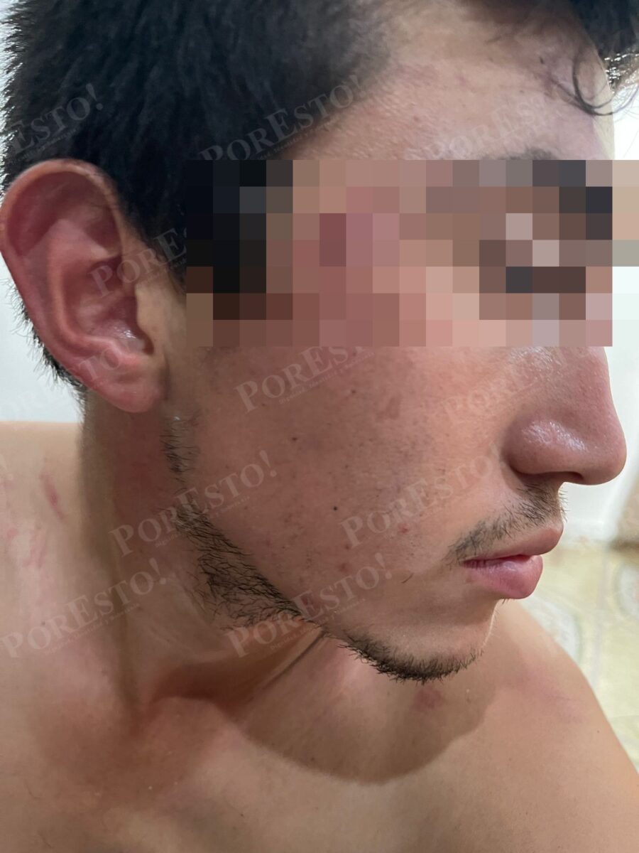 Golpiza a José Eduardo Ravelo