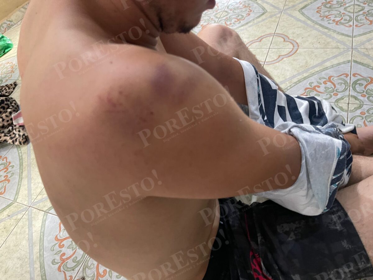Foto de José Eduardo Ravelo golpeado