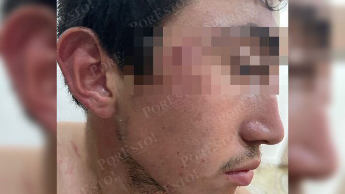 Fotos de la golpiza a José Eduardo Ravelo