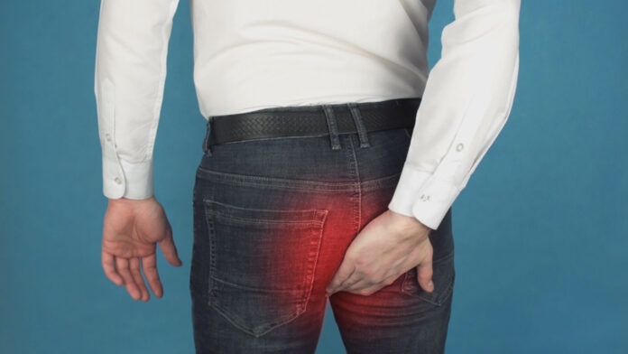 prevenir hemorroides gay pasivo