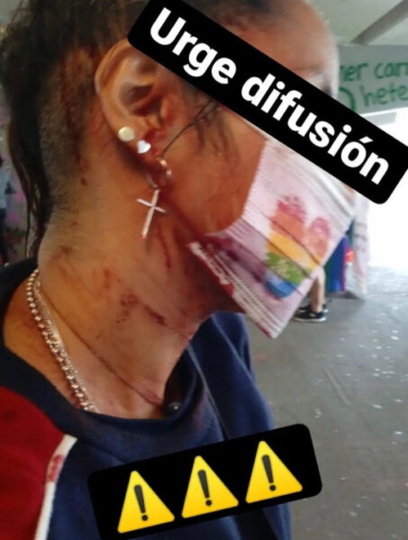 la tianguis disidente lgbt glorieta de los insurgentes agresión