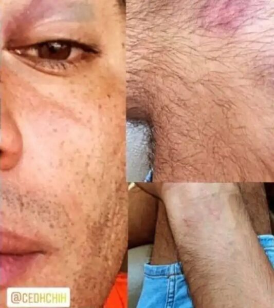 Golpiza a Pareja gay en Chihuahua