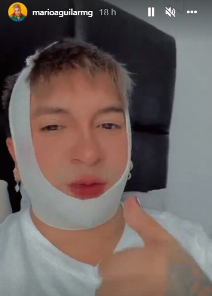 Mario Aguilar habla sobre su cirugía