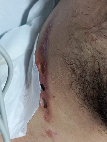 Discriminación vih imss D cuello urgencias