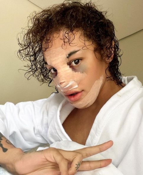 drag queen Pabllo Vittar rinoplastia