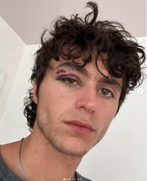 el vilsito agresión homofóbica taquería