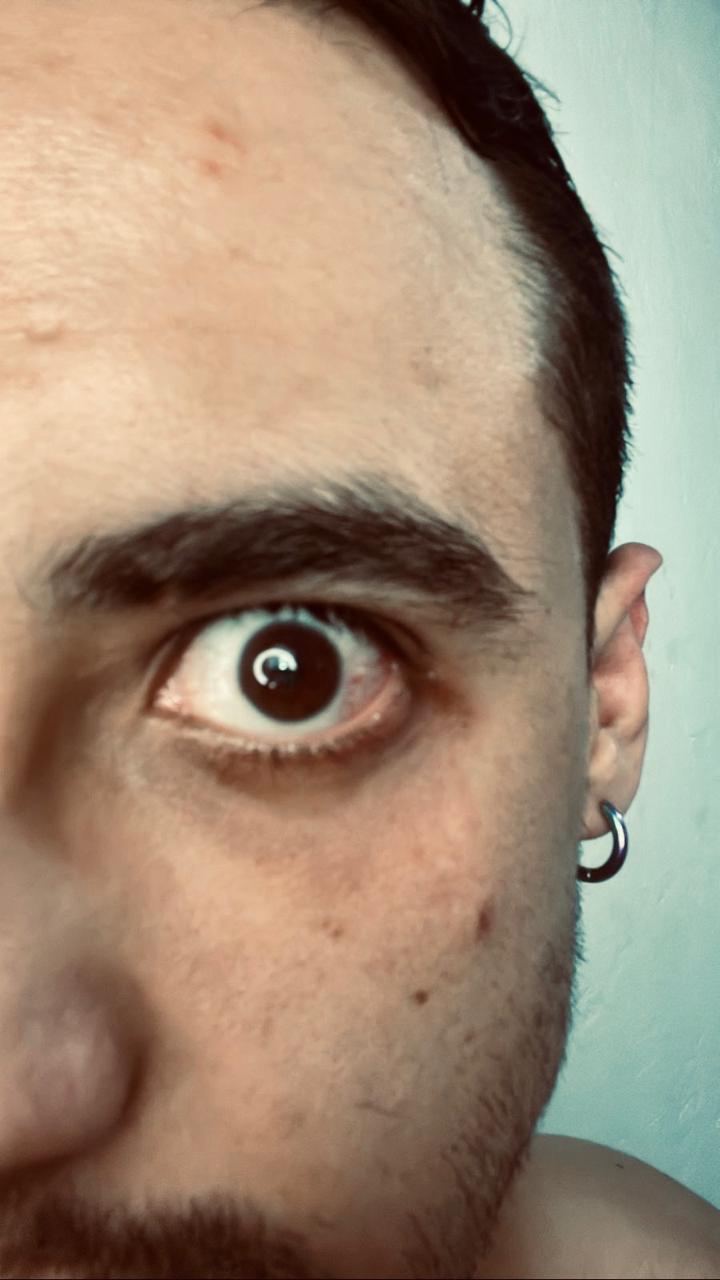 Agrasión a pareja gay de CDMX con fibra de vidrio