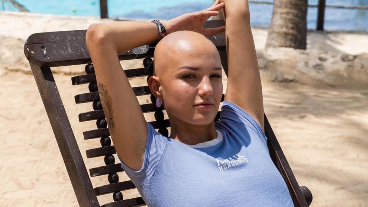 camila-solorzano-modelo-alopecia camila-solorzano-modelo-alopecia