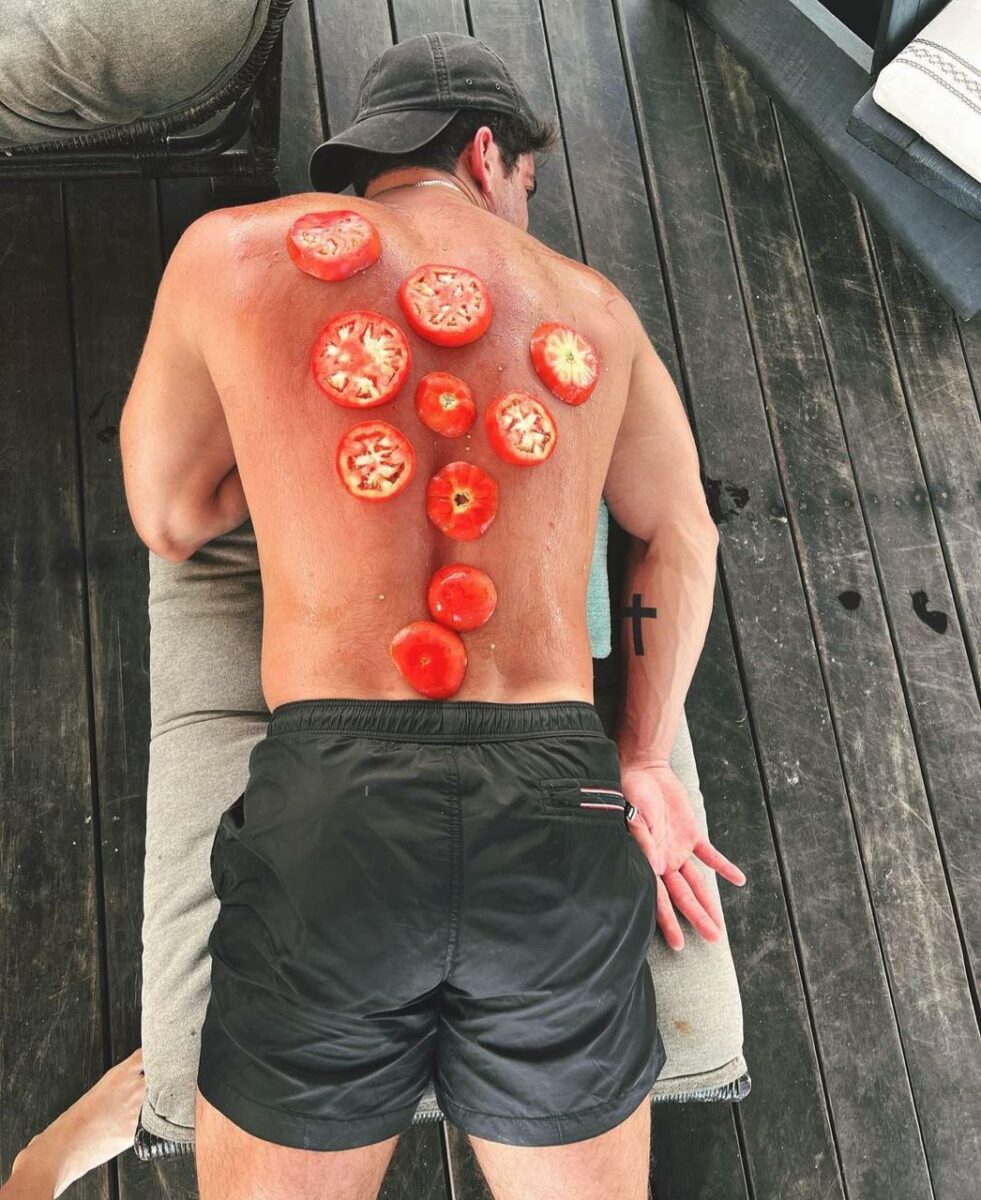 Mauricio Garza espalda quemada con jitomates