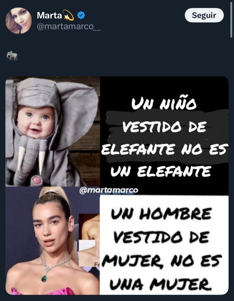 Dua lipa cantante es trans
