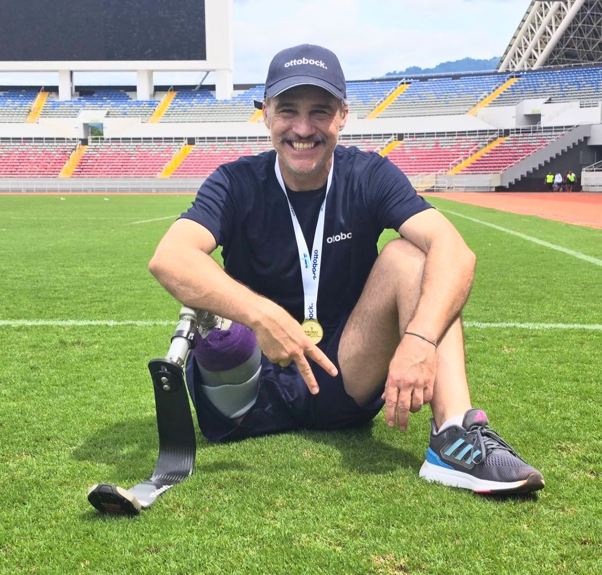 Juan Pablo Medina actor prótesis hoy 2024