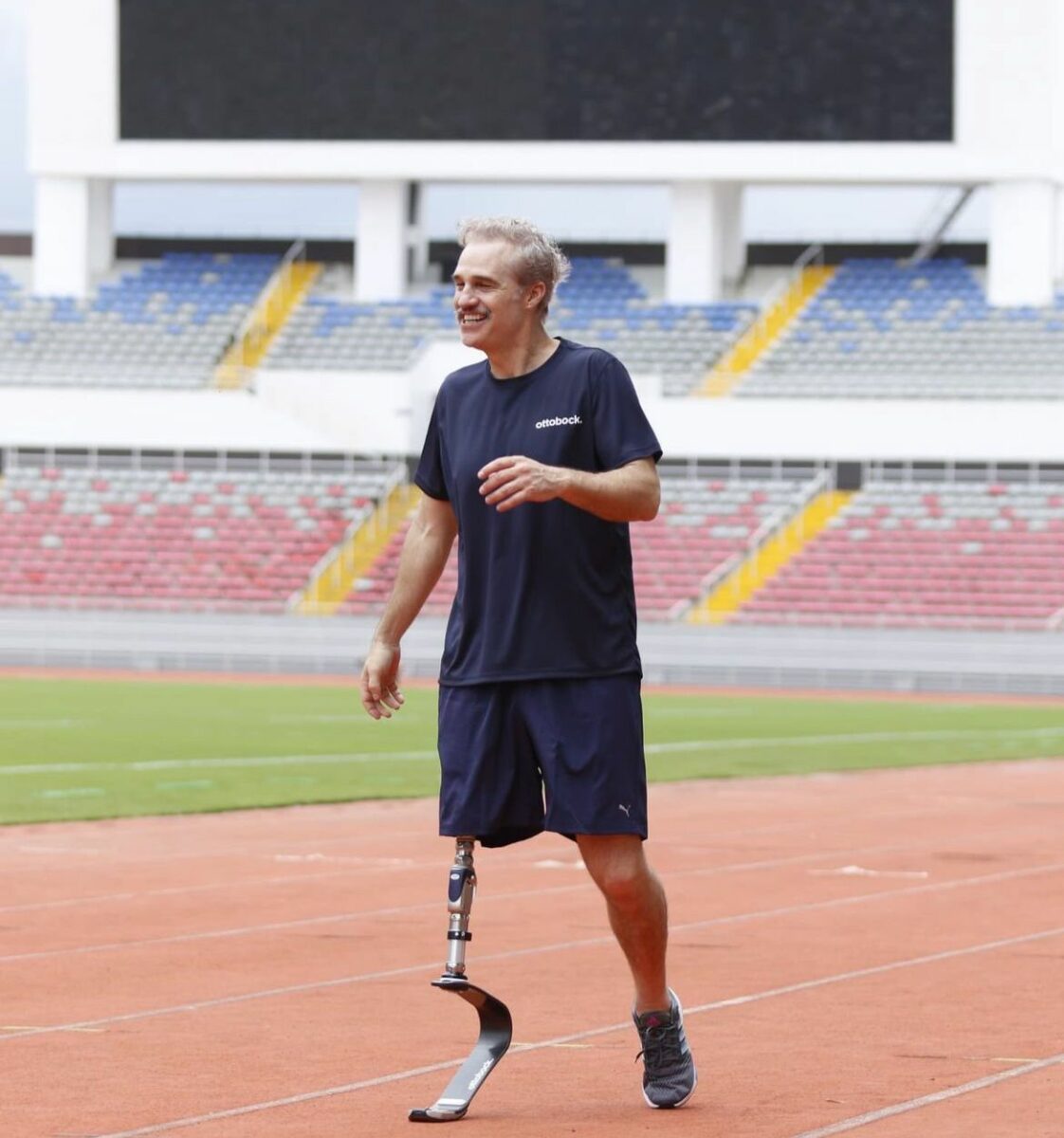 Juan Pablo Medina con prótesis